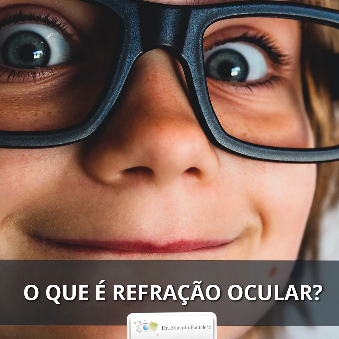 O que é refração ocular? | Dr. Eduardo Pantaleão